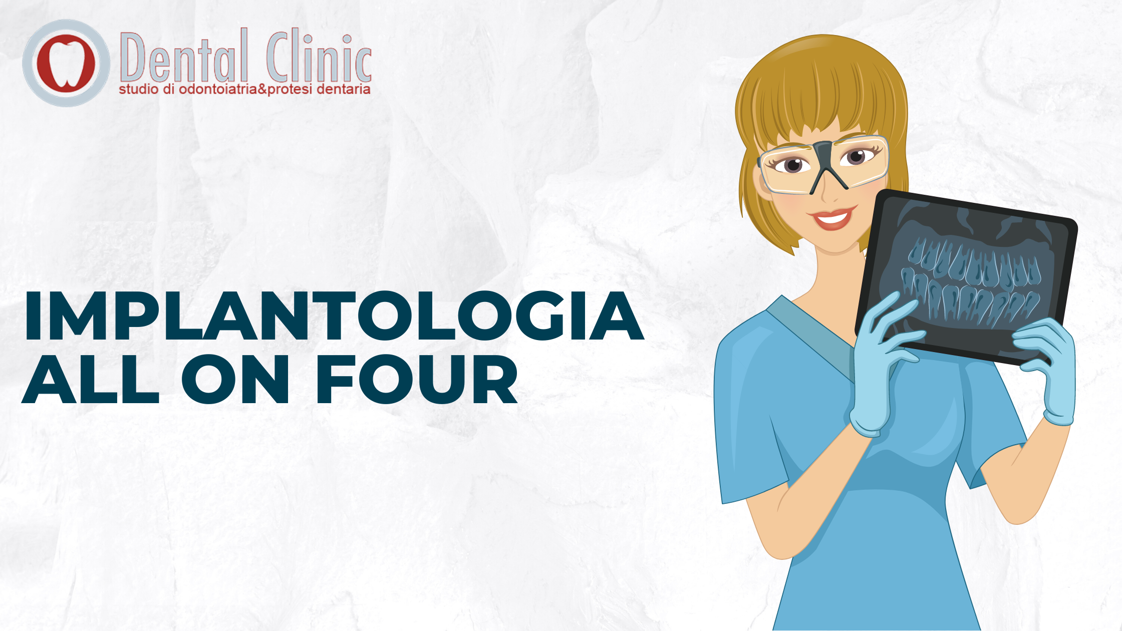 Implantologia All on Four