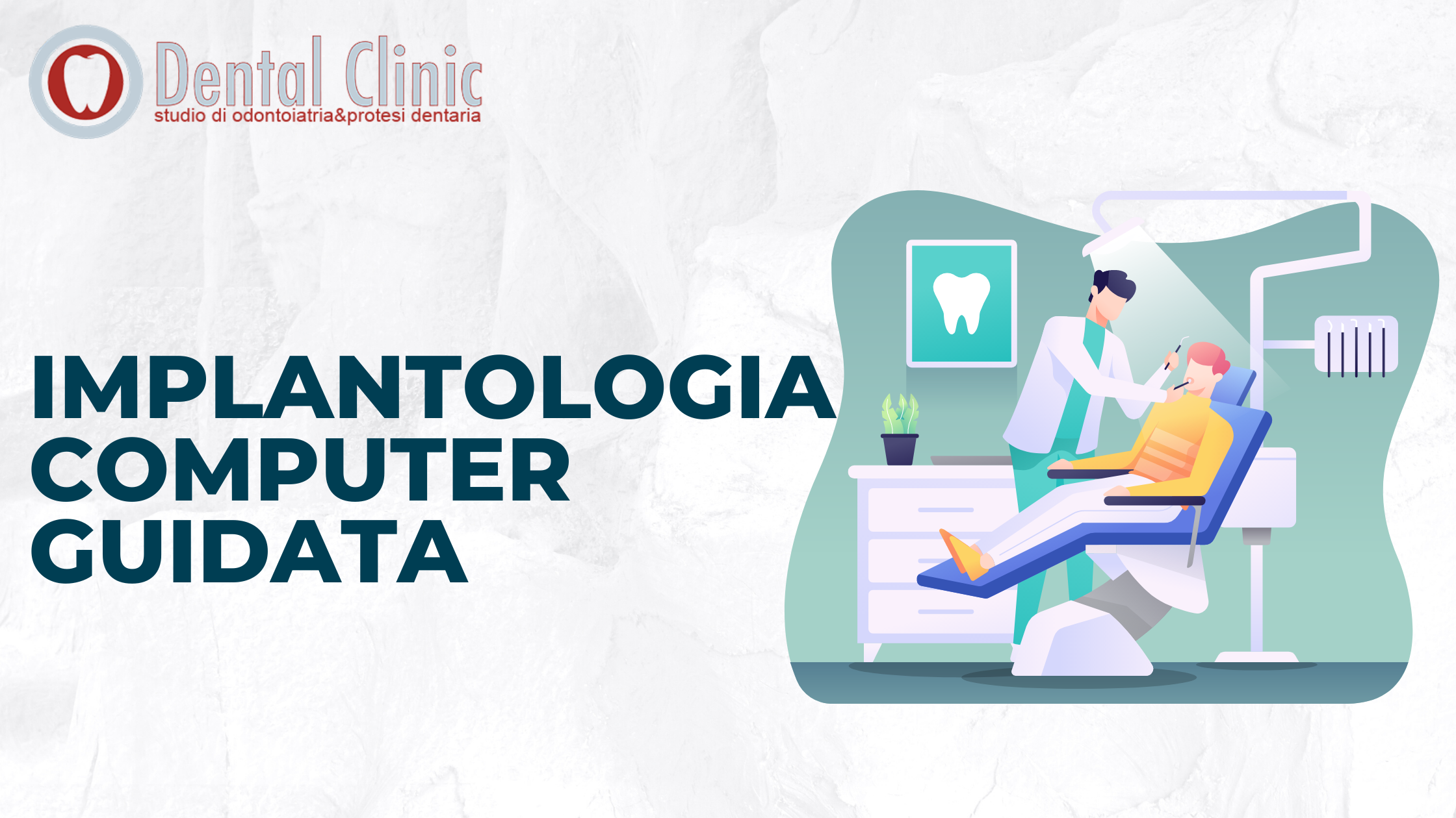 Implantologia Guidata