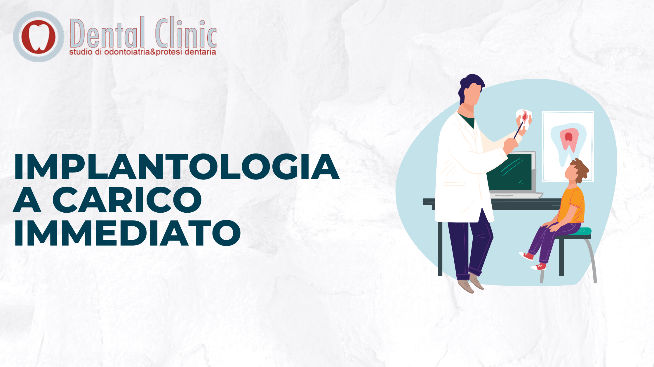 Implantologia a carico immediato