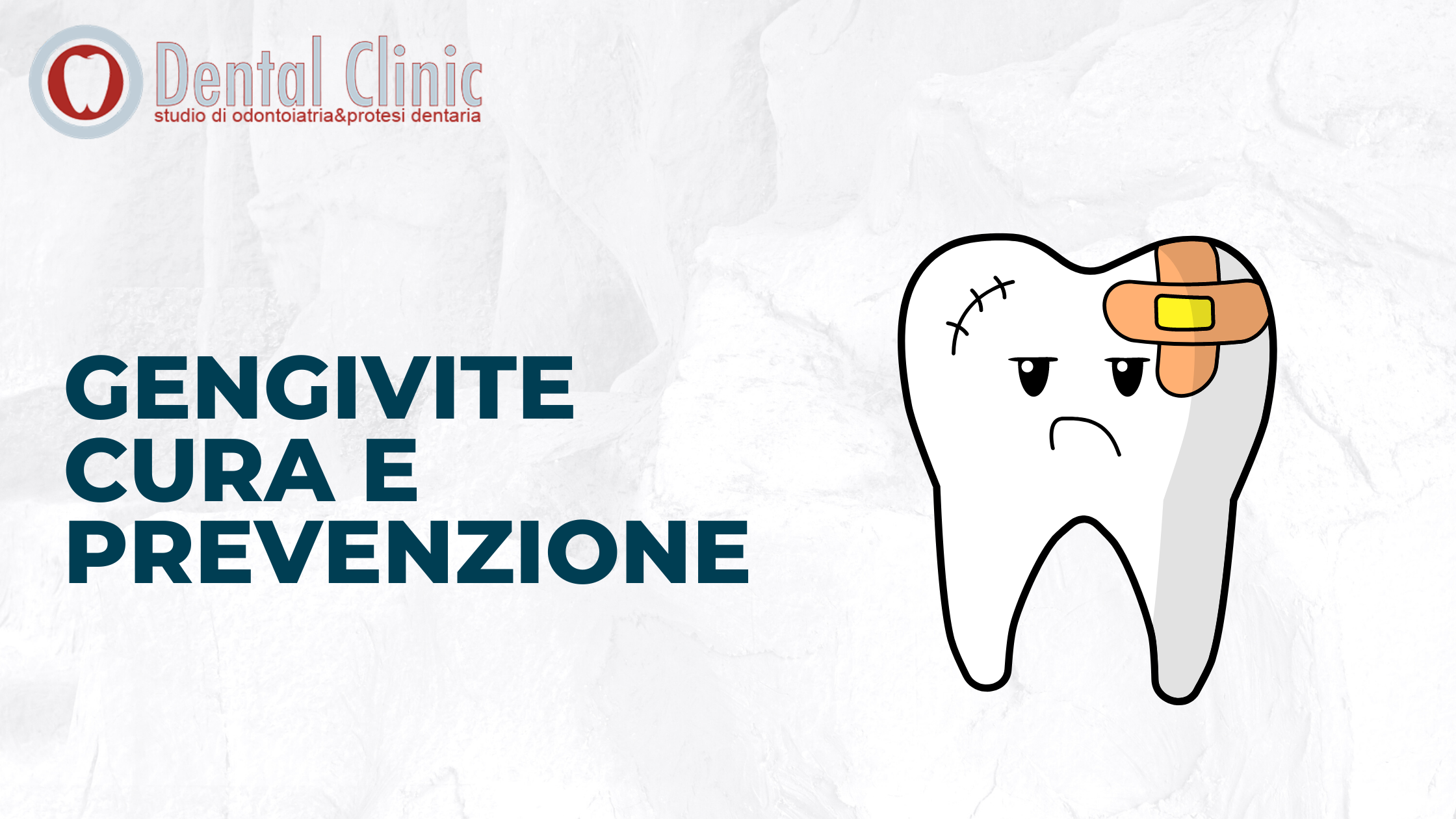 Gengiviti e Infiammazione: cura e prevenzione