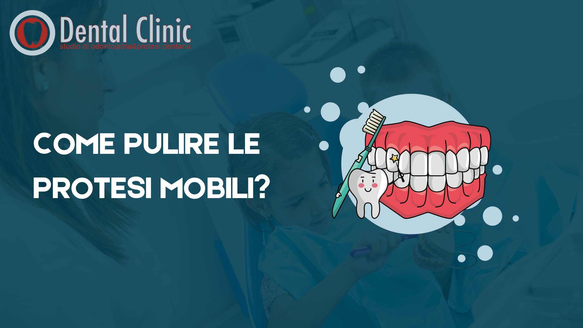 Pulire le protesi mobili. Segui questi consigli.