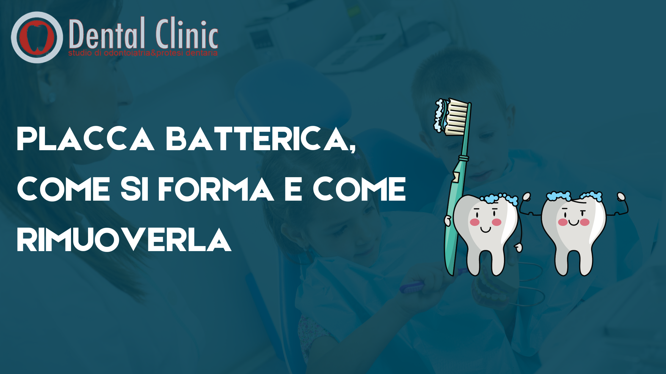 Placca batterica: come si forma e come rimuoverla